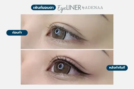 Adenaa-Generel-Costomer_Eyeliner-Lot1-C10-01_10 Adenaa-Generel-Costomer_Eyeliner-Lot1-C10-01_10
