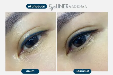 Adenaa-Generel-Costomer_Eyeliner-Lot1-C6-01_6 Adenaa-Generel-Costomer_Eyeliner-Lot1-C6-01_6