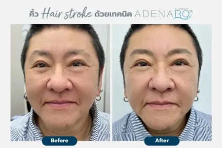 Adenaa-Generel-Costomer_Hair-Stroke-Lot-D1-01