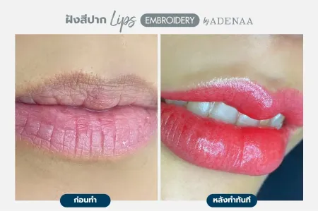 Adenaa-Generel-Costomer_Lips-Lot1-C1-01