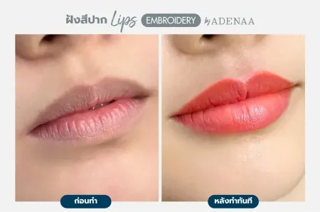 Adenaa-Generel-Costomer_Lips-Lot1-C2-01
