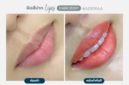 Adenaa-Generel-Costomer_Lips-Lot1-C3-01