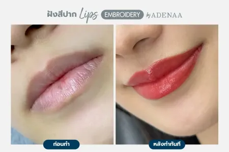 Adenaa-Generel-Costomer_Lips-Lot1-C4-01