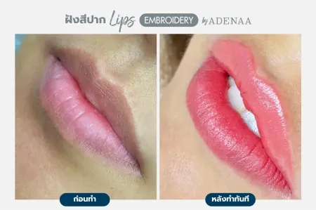 Adenaa-Generel-Costomer_Lips-Lot1-C5-01