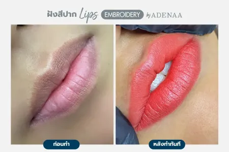Adenaa-Generel-Costomer_Lips-Lot1-C6-01