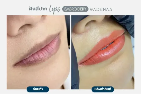 Adenaa-Generel-Costomer_Lips-Lot1-C7-01