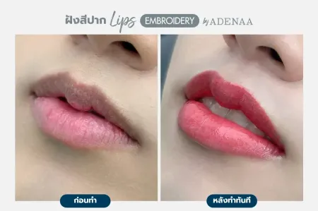 Adenaa-Generel-Costomer_Lips-Lot2-C10-01_10_11zon