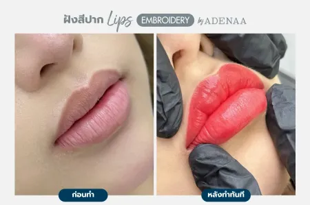 Adenaa-Generel-Costomer_Lips-Lot2-C11-01_11_11zon