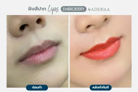 Adenaa-Generel-Costomer_Lips-Lot2-C12-01_12_11zon
