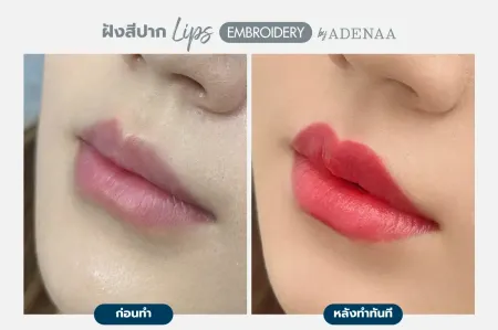 Adenaa-Generel-Costomer_Lips-Lot2-C13-01_13_11zon