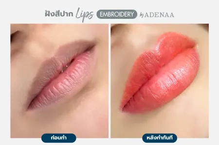 Adenaa-Generel-Costomer_Lips-Lot2-C3-01_3_11zon