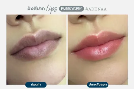 Adenaa-Generel-Costomer_Lips-Lot2-C4-01_4_11zon