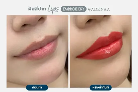 Adenaa-Generel-Costomer_Lips-Lot2-C7-01_7_11zon