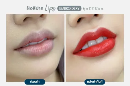 Adenaa-Generel-Costomer_Lips-Lot2-C8-01_8_11zon