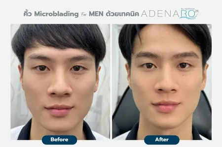 Adenaa-Generel-Costomer_Microblading-For-Men-Lot-D1-01
