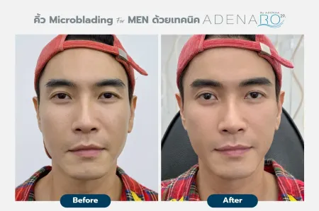 Adenaa-Generel-Costomer_Microblading-For-Men-Lot-D2-01