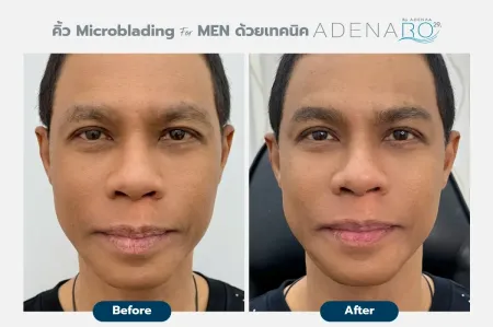 Adenaa-Generel-Costomer_Microblading-For-Men-Lot-D3-01