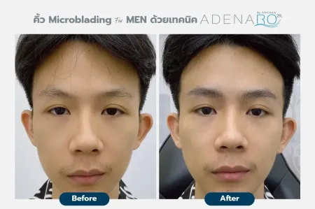 Adenaa-Generel-Costomer_Microblading-For-Men-Lot2-C1-01_1_11zon