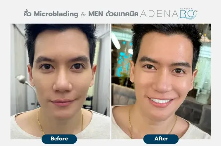 Adenaa-Generel-Costomer_Microblading-For-Men-Lot2-C10-01_10_11zon