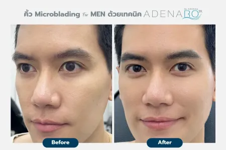 Adenaa-Generel-Costomer_Microblading-For-Men-Lot2-C11-01_11_11zon