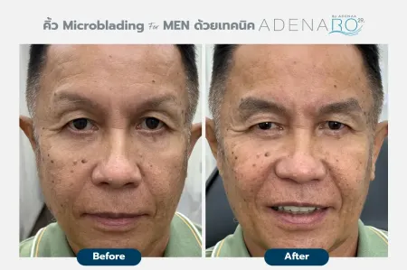 Adenaa-Generel-Costomer_Microblading-For-Men-Lot2-C7-01_7_11zon
