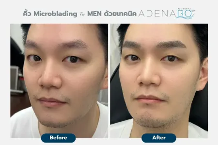Adenaa-Generel-Costomer_Microblading-For-Men-Lot2-C9-01_9_11zon