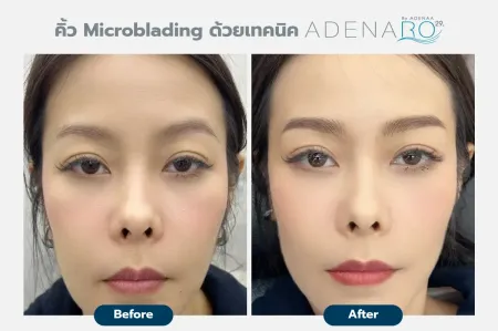 Adenaa-Generel-Costomer_Microblading-Lot-D1