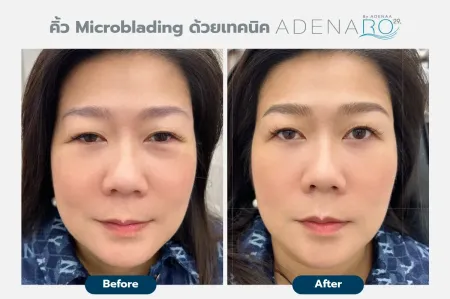Adenaa-Generel-Costomer_Microblading-Lot-D10