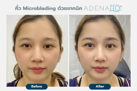 Adenaa-Generel-Costomer_Microblading-Lot-D2