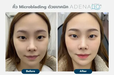 Adenaa-Generel-Costomer_Microblading-Lot-D4