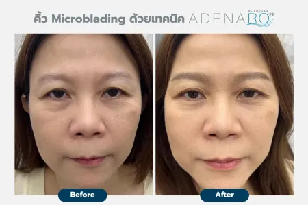 Adenaa-Generel-Costomer_Microblading-Lot-D5