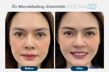 Adenaa-Generel-Costomer_Microblading-Lot-D6