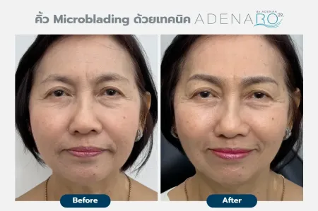 Adenaa-Generel-Costomer_Microblading-Lot-D7
