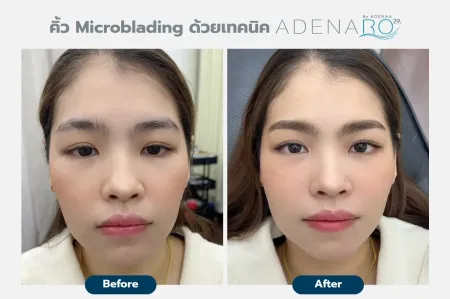 Adenaa-Generel-Costomer_Microblading-Lot-D8