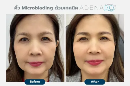 Adenaa-Generel-Costomer_Microblading-Lot-D9