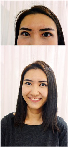 แชร์ประสบการณ์สักคิ้วสามมิติ ที่ Adenaa Clinic by Girl's Friend Club แชร์ประสบการณ์สักคิ้วสามมิติ ที่ Adenaa Clinic by Girl's Friend Club