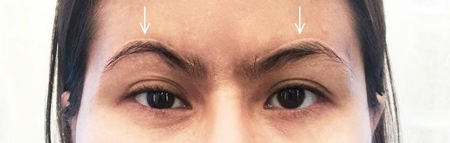 Eyebrow tattoo to cover scars