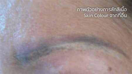 Remove eyebrow tattoos with laser