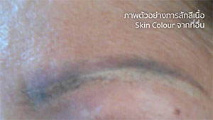eyebrow tattoo removal eyebrow tattoo removal