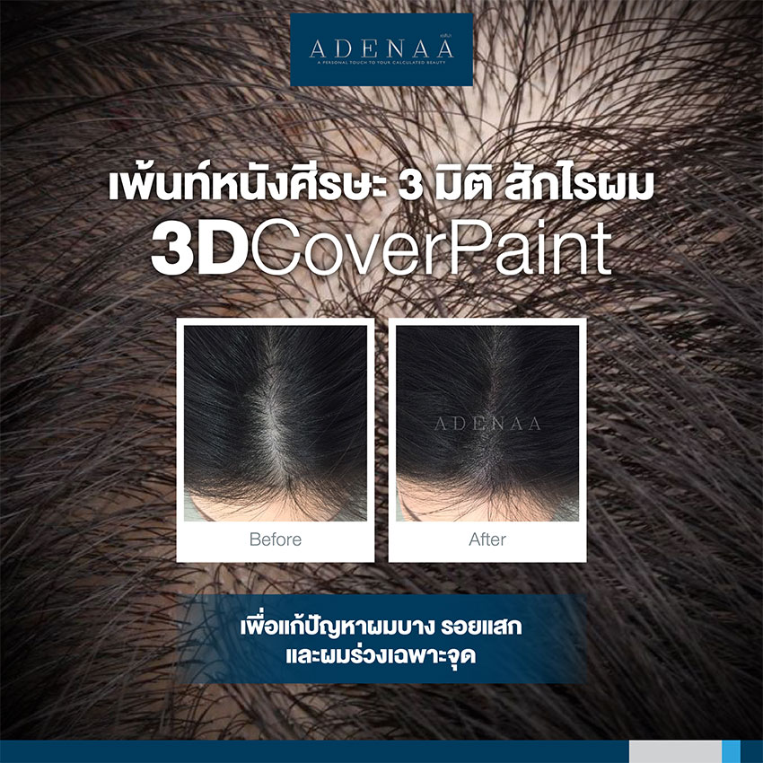 สักไรผม เพ้นท์หนังศีรษะ3มิติ (3D Cover Paint) สักไรผม เพ้นท์หนังศีรษะ3มิติ Cover Paint)