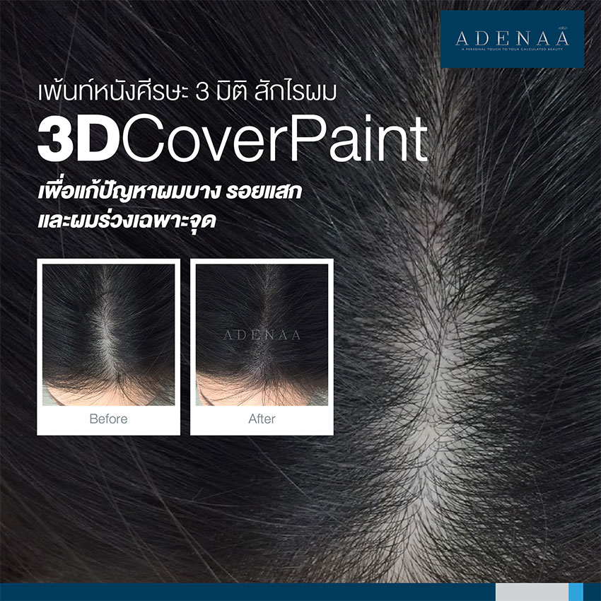 Hairline tattoo, 3D scalp painting (Cover Paint)