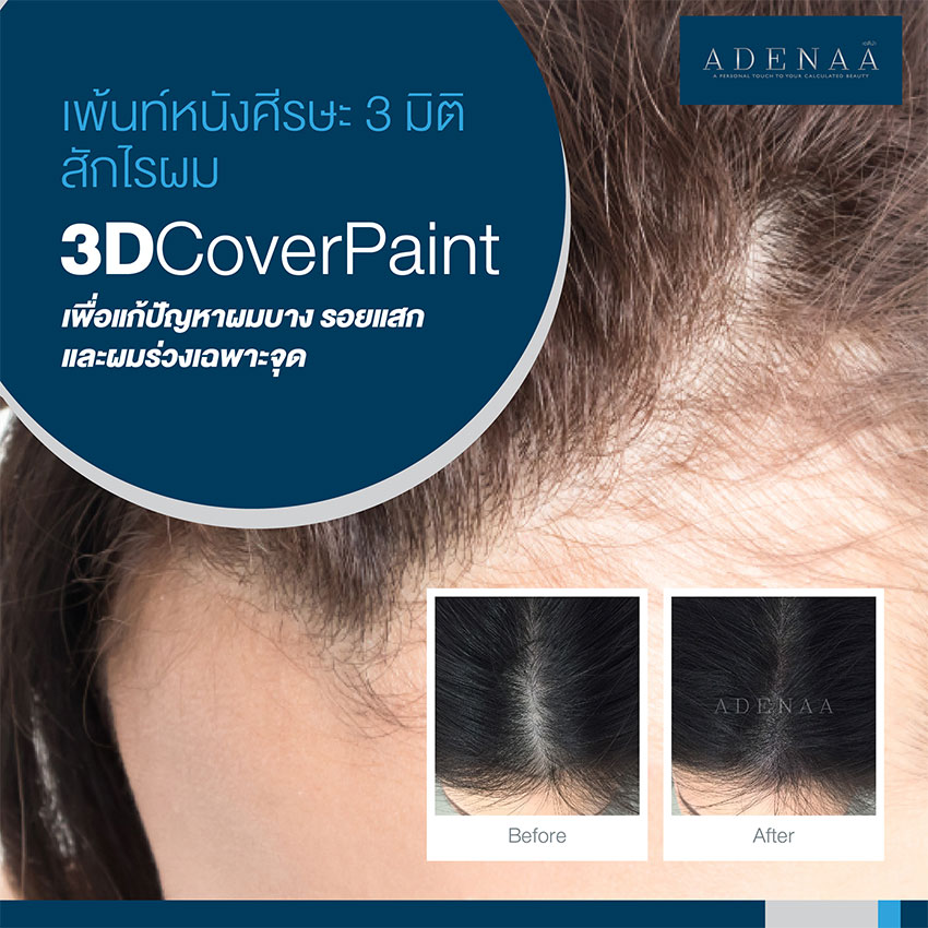 Hairline tattoo, 3D scalp painting (Cover Paint)