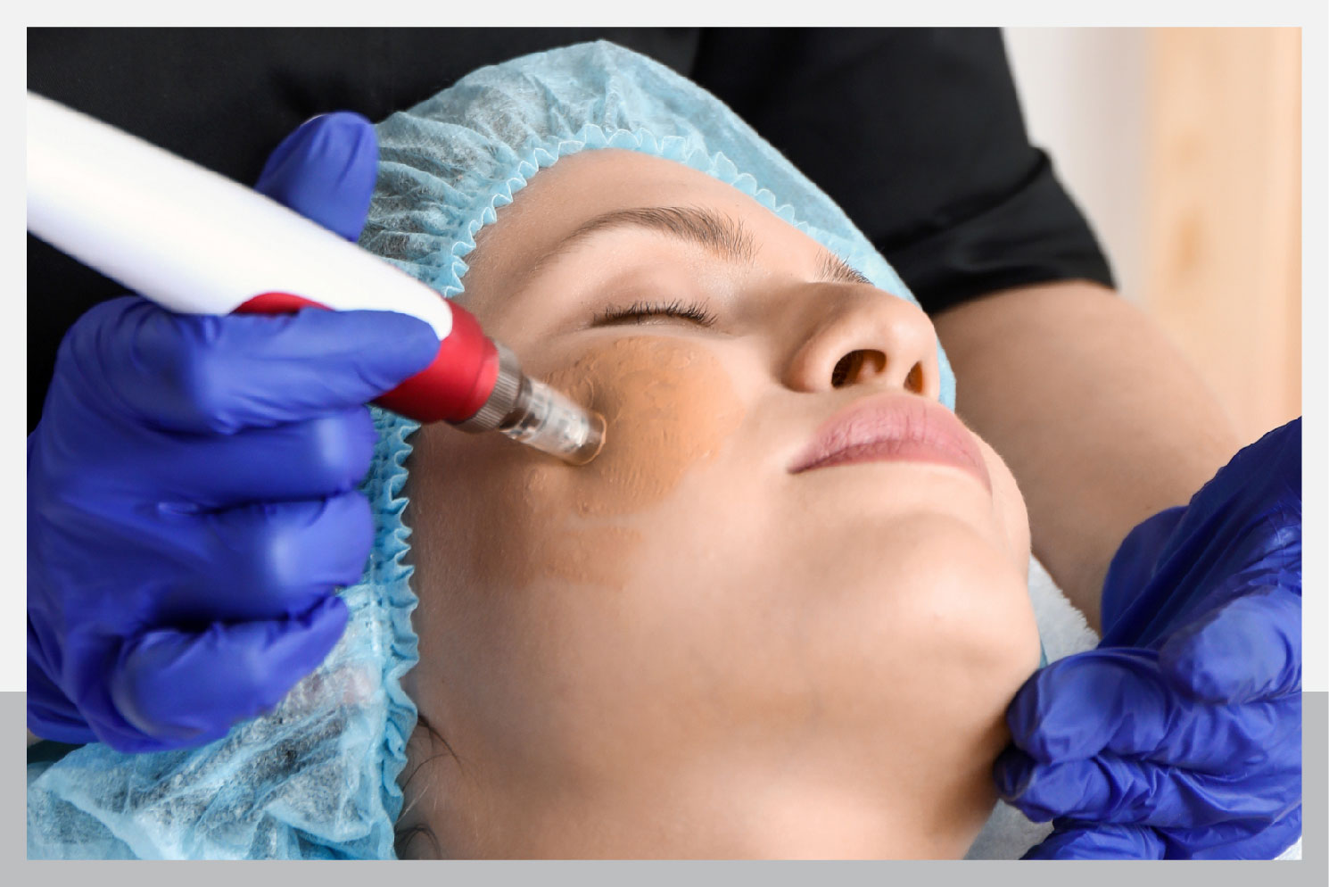 New trend for clear, glowing skin by tattooing foundation on the face.