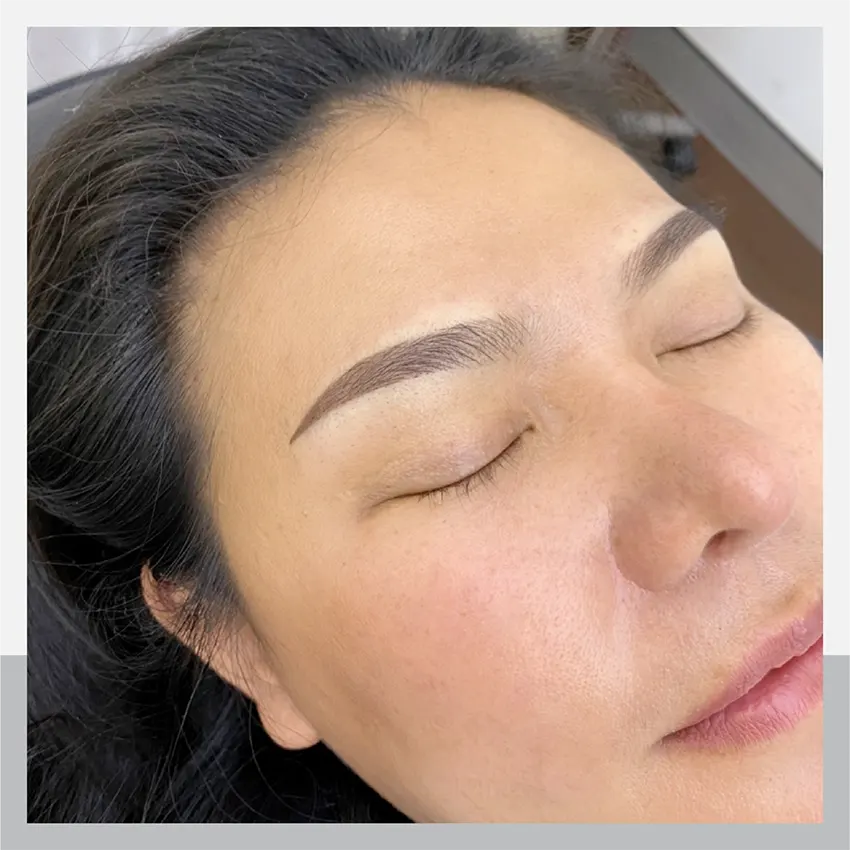 In the case of eyebrow loss due to severe allergic reaction to cosmetics, it can be fixed with Ombre.