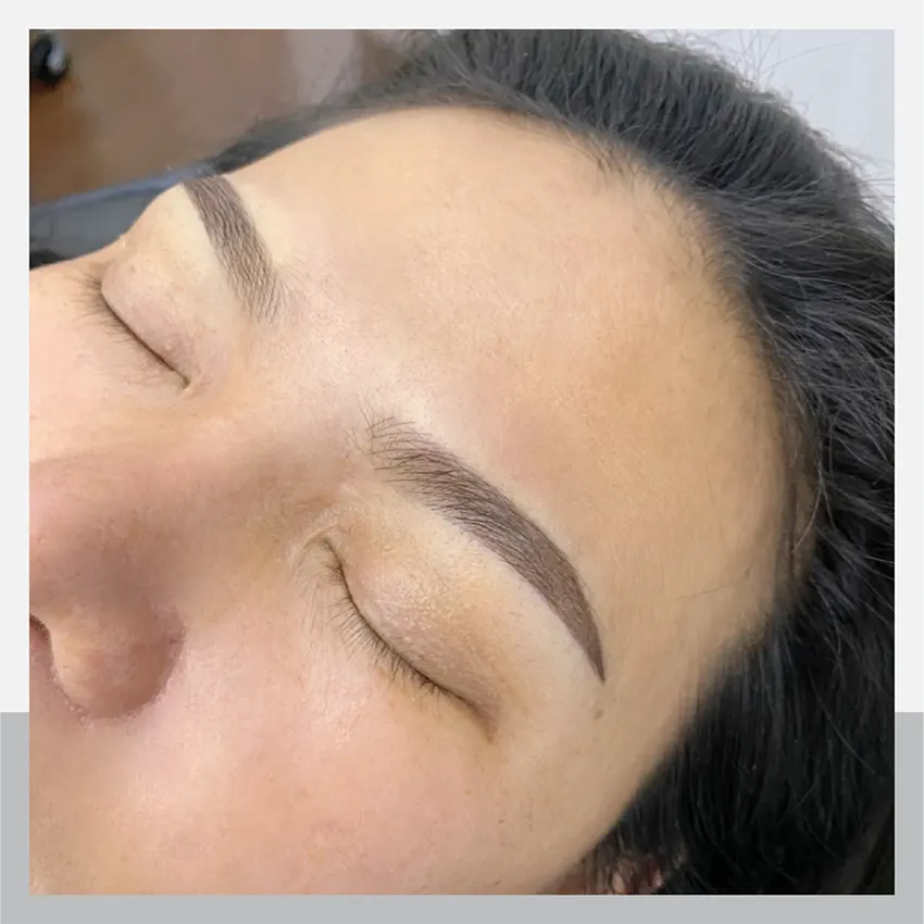 In the case of eyebrow loss due to severe allergic reaction to cosmetics, it can be fixed with Ombre.