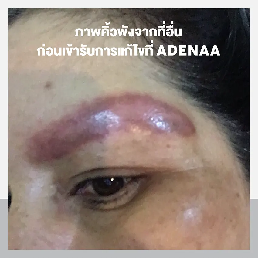 คิ้วพังรีวิวลบคิ้วผิดวิธี