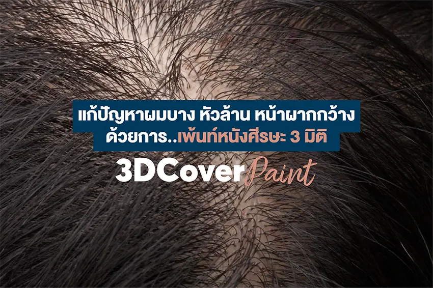 แก้ปัญหาผมบาง หัวล้าน หน้าผากกว้าง ด้วยการเพ้นท์หนังศีรษะ 3 มิติ แก้ปัญหาผมบาง หัวล้าน หน้าผากกว้าง ด้วยการเพ้นท์หนังศีรษะ 3 มิติ