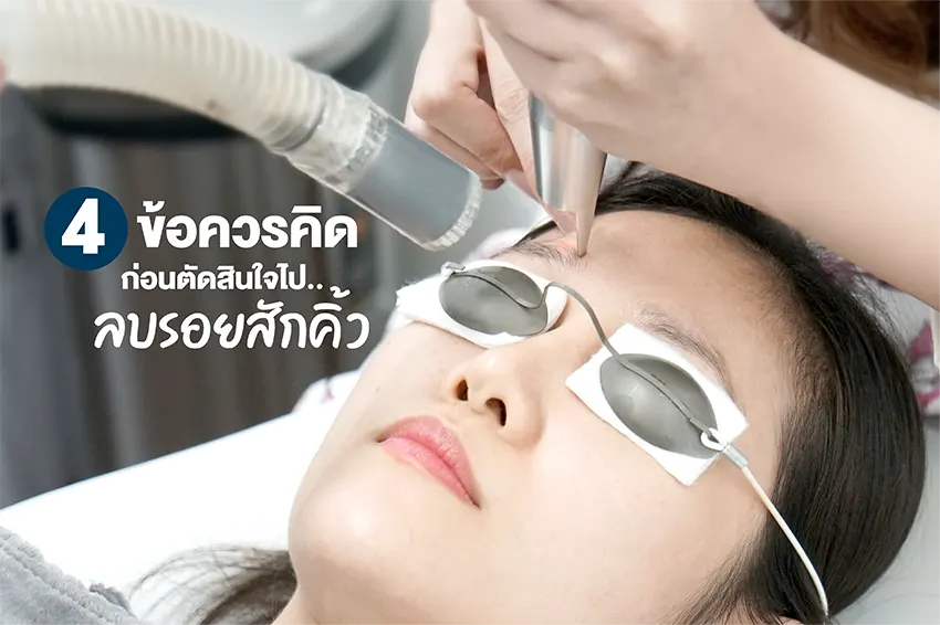 4 ข้อควรคิดก่อนตัดสินใจไปลบรอยสักคิ้ว 4 ข้อควรคิดก่อนตัดสินใจไปลบรอยสักคิ้ว