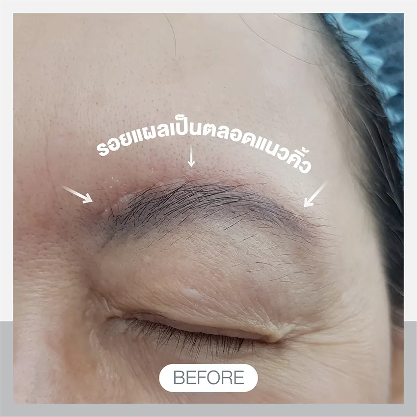 3D eyebrow painting, cosmetic surgery