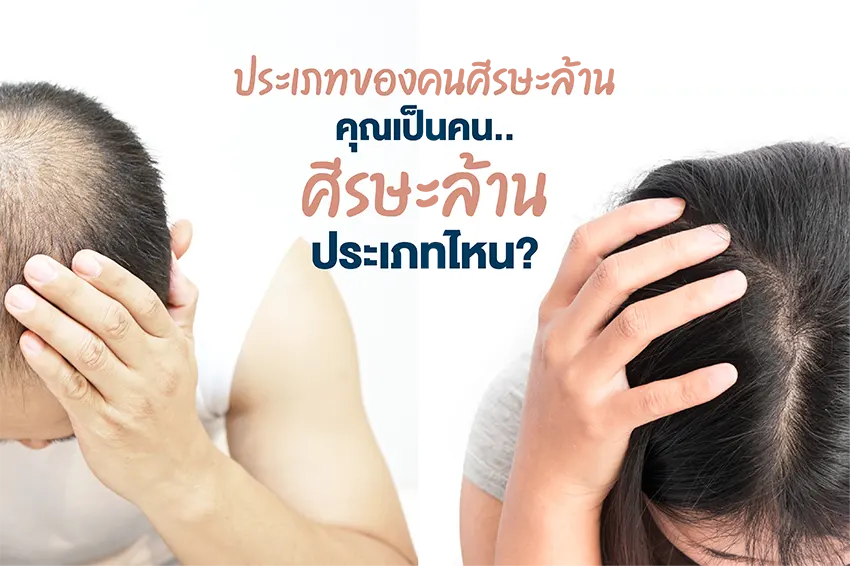 Types of bald people What type of bald person are you? Types of bald people What type of bald person are you?